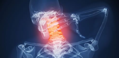 Cervicothoracic Interspinous Bursitis Neck Pain