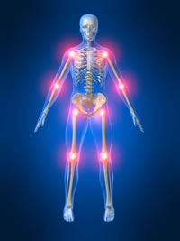 Chronic Pain Disorders
