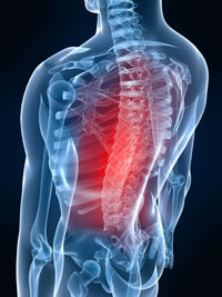 Thoracic Radiculopathy Pain Relief